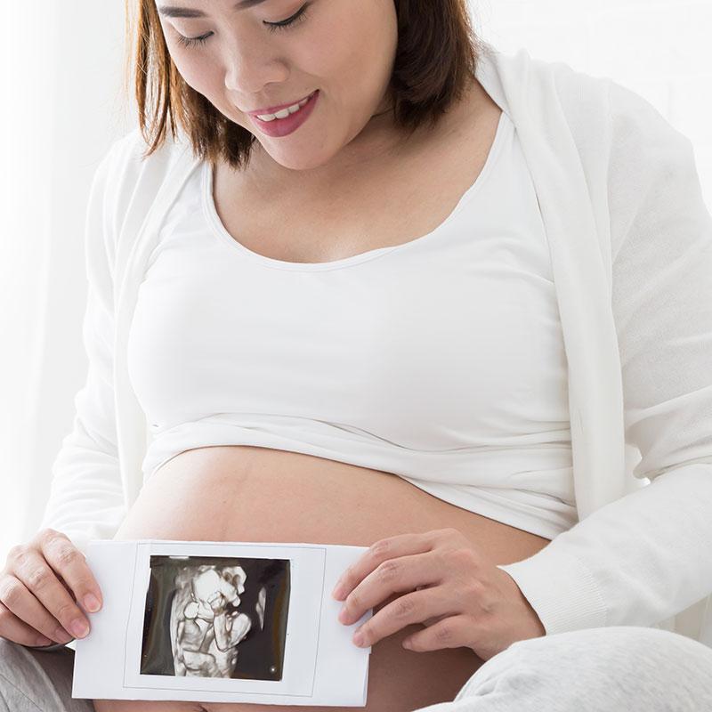 Sponsor 3D/4D Plus Gender (Non-Diagnostic Ultrasounds)